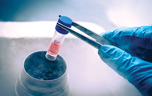 Frozen Embryo Transfer (FET)